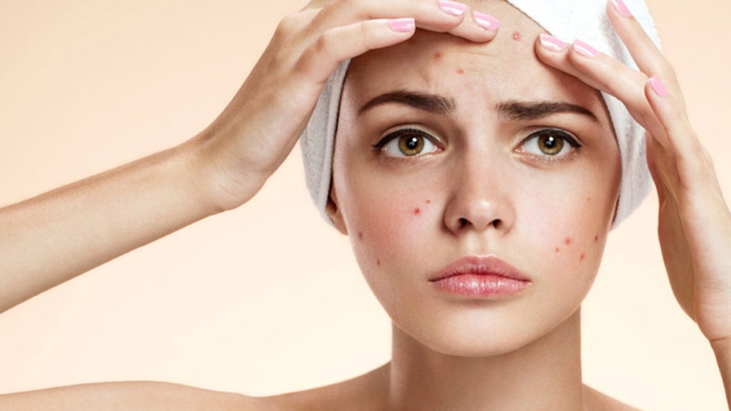 Svinde bort fedme en anden The best ingredients to combat acne-prone skin and bad skin days - GUAP